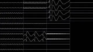 MandraSigma - Sunrise (Oscilloscope View)