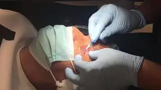 HAPPY 2020 LASIK PATIENTS!