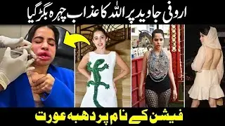 Urfi Javed's Swollen Face | The Dark Side of Beauty Fillers Exposed!