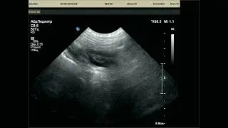 V 20250316 081014