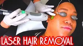LASER HAIR REMOVAL | PatrickStarrr