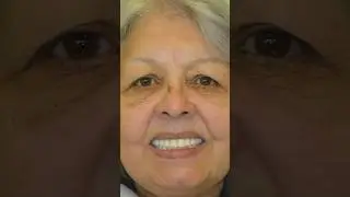 Milagros came to us with failing dental implants &mdash; and left with a smile that says it all! #allon4