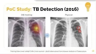 Deep Learning on Healthcare (4): Story of Lunit (1)