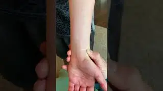 Palpation: Styloid Process of Radius