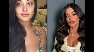 Transforma&ccedil;&otilde;es est&eacute;ticas de Aline Campos voltam a gerar discuss&atilde;o ap&oacute;s sa&iacute;da do 'BBB 26'