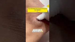🔥Get Fair Feet in 5Minutes/Remove Suntan Easily At Home/Easy pedicure#skincare #shorts #viralvideo