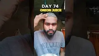 Day 74 use onion juice for hair regrowth #hairregrowthtreatment #hairfall