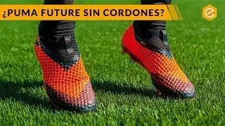 &iquest;DEBER&Iacute;A QUITAR los CORDONES como MARCO REUS?