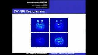 Prof. Sofia Olhede | Non-parametric estimation of HARDI diffusion weighted magnetic resonance......