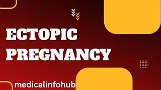 Ectopic Pregnancy || Signs & Symptoms || Management