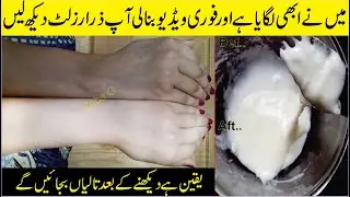 I Am Removing Complete Sun Tan /Dark Skin 20 Minutes Join Me: Beauty Tips At Home: Skincare Tips