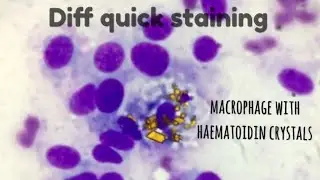 Diff quick staining procedure and interesting case photos
