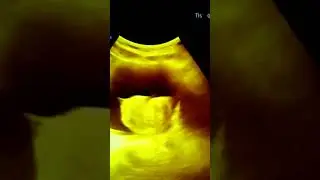 BEP