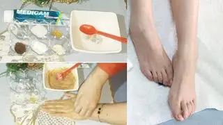 Homemade Whitening Cream For Private Parts  | Get Brighter Underarms, Knees, Elbows, Inner Thighs
