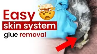 How to Clean Glue Off a Skin Hair System the EASY Way!