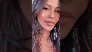 3 MONTHS AFTER REVISION RHINOPLASTY