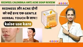 Richfeel Calendula Anti Acne Soap Use in Hindi | Price  | Side Effect | Benefits | how To Use |💊✅