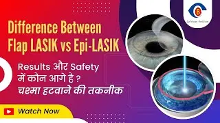Difference between Epi-LASIK vs Flap LASIK Surgery - Thin Cornea के लिए कौन सही है, जानिए फर्क?