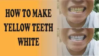 HOW TO MAKE YOUR YELLOW TEETH WHITE N PHOTOSHOP