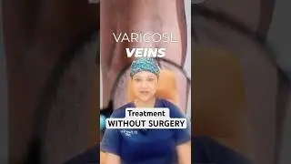Non-Surgical Treatment for Varicose Veins in Delhi NCR | How Interventional Radiology Helps