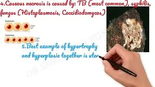 RAPID REVISION #shorts #medicalshorts #pathology