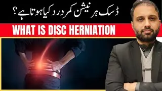 What is disc herniation back pain | Disc Herniation Pain | Herniated Disc Symptoms