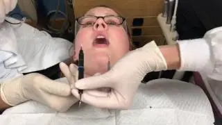 Single Handed Transfer Technique