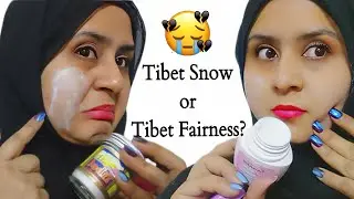 Tibet Cream For Skin Whitening? Tibet Snow Vs Tibet Fairness Cream || Cream Comparison