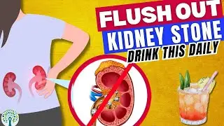 Dissolve Kidney stones Naturally | Flush Out Kidney Stones | #healthlink  #kidney #kidneydisease