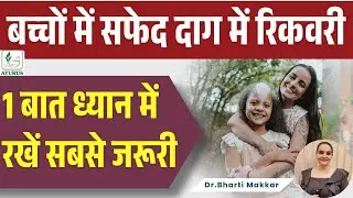 Why Vitiligo Recovery Slows Down in Children #drbhartimakkar