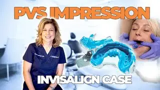 How to take PVS Impressions with a Triple Tray