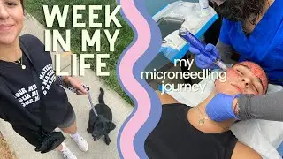 Microneedling recovery, fave jewelry, new nails | WEEKLY VLOG | nattbfit