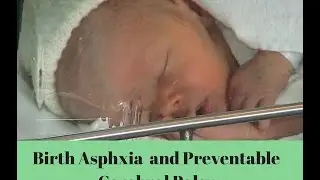 How oxygen deprivation at birth can cause Cerebral Palsy