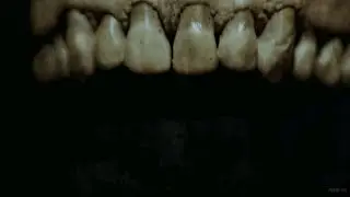 SCHIZOGEN - BIOLOGICAL DAMAGE PROCESSES [OFFICIAL MUSIC VIDEO] (2020) SW EXCLUSIVE