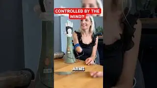 Man Controls TWO Robotic Arms with His Mind 🤯