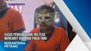 Kasus Penganiayaan, Ibu Tega Mencabut Gigi Anak Pakai Tang