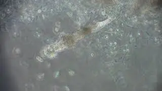 Coleps Swarm