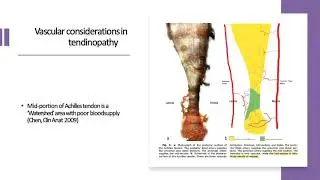 Update on tendinopathy