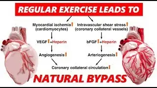 NATURAL BYPASS BY EXERCISE | Explained in Hindi | Dr.Education
