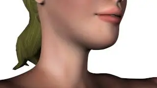 Thermi RF Face, Neck, Body, and Breast lifting