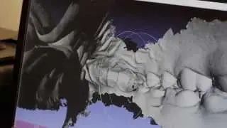 Why We Use a 3D Scanner