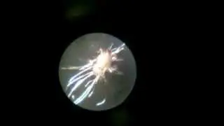 Acarien au microscope - Name this mite