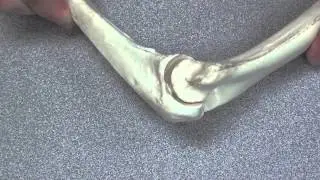 Elbow Bones