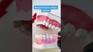 Как пользоваться ершиками для зубов?