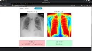 Dynamic Website Interface for Diagnosing Corona Victims from X rays