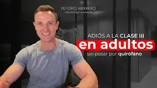 ¿Cómo tratar la MALOCLUSIÓN EN CLASE 3 en adultos? - Clínica Peydro