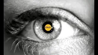 CELO FIXINGS FRANCE - l'importance des petits d&eacute;tails