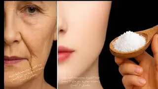 أقسم بالله ملعقة ملح واحدة ستخلصك من تجاعيد الوجه كأنك في20 من عمرك مجربة ومضمونة💯 