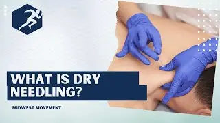 What is Dry Needling?  /   Midwest Movement
