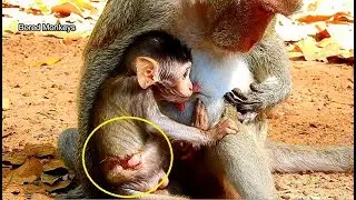 Newest update:Baby Janet nearly complete recover-wound look better not so hurt make baby more active